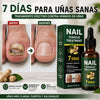 🥇 7DAYS™ – Recupera la Apariencia Sana de tus Uñas 🔥 OFERTA 2x1
