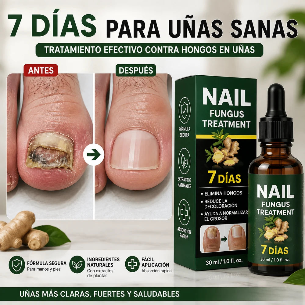 🥇 7DAYS™ – Recupera la Apariencia Sana de tus Uñas 🔥 OFERTA 2x1