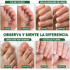 🥇 7DAYS™ – Recupera la Apariencia Sana de tus Uñas 🔥 OFERTA 2x1