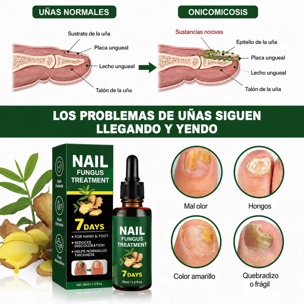 🥇 7DAYS™ – Recupera la Apariencia Sana de tus Uñas 🔥 OFERTA 2x1