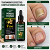 🥇 7DAYS™ – Recupera la Apariencia Sana de tus Uñas 🔥 OFERTA 2x1