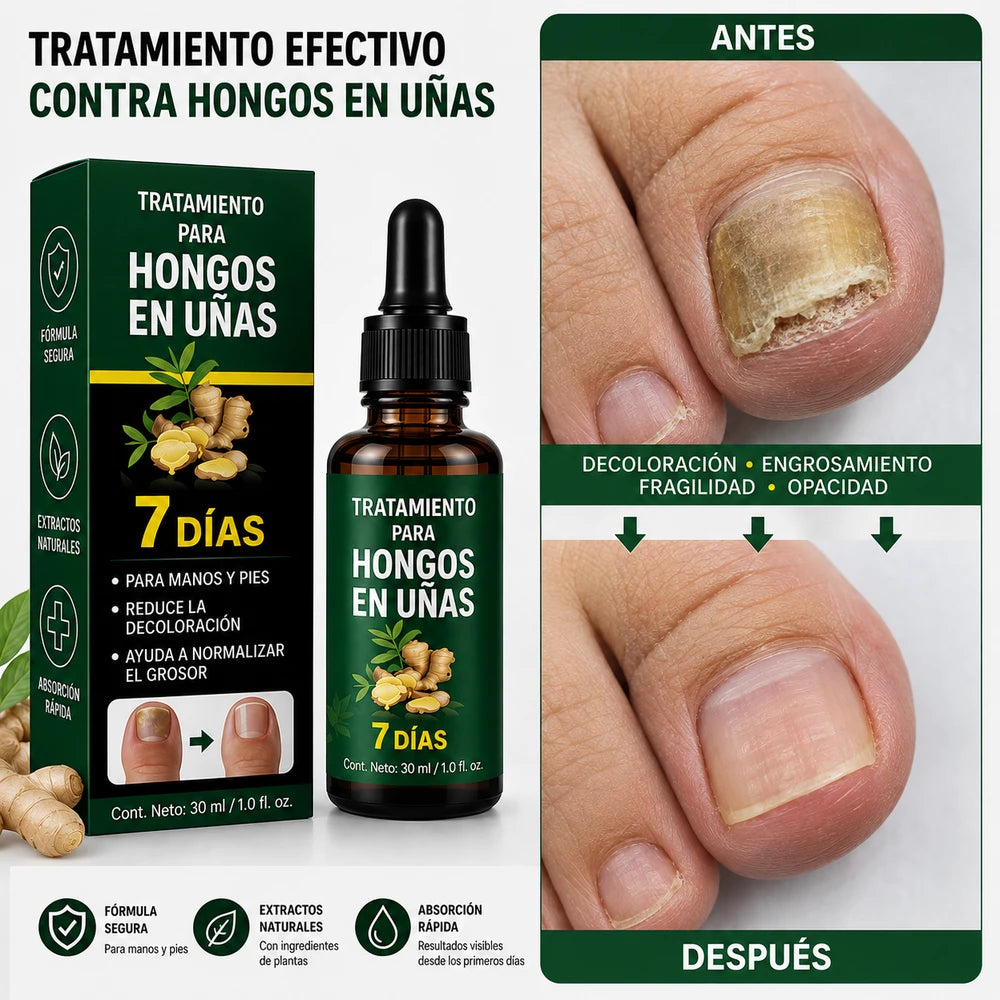🥇 7DAYS™ – Recupera la Apariencia Sana de tus Uñas 🔥 OFERTA 2x1